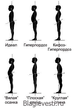 Растяжки на ПравИле. Расправьте плечи, чтобы вернуть красоту и здоровье. Растяжки на ПравИле. Расправьте плечи, чтобы вернуть красоту и здоровье.